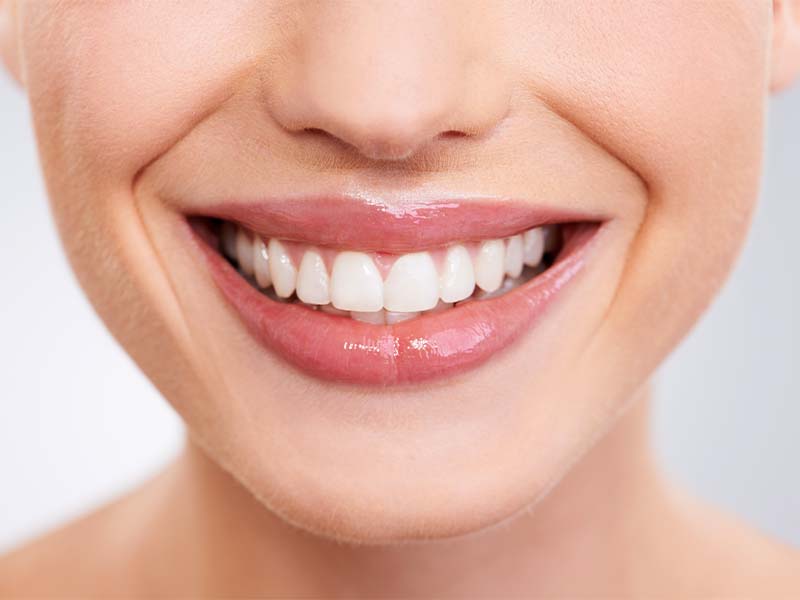 Healthy teeth close-up